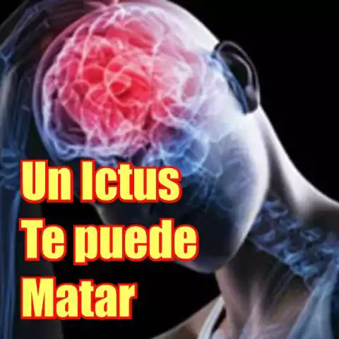 Que es el ictus Derrame cerebral bomtopia redes sociales 1